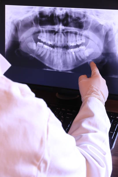 Best Walk-In Emergency Dentist in Spring Lake Park, MN
